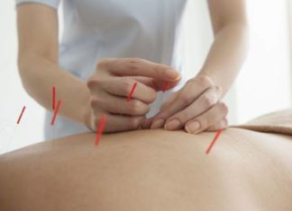 Что за метод похудения с использованием электроакупунктуры?