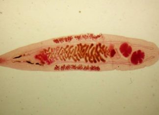 Что за вызывающий рак «сибирский червь» может попасться в рыбе?