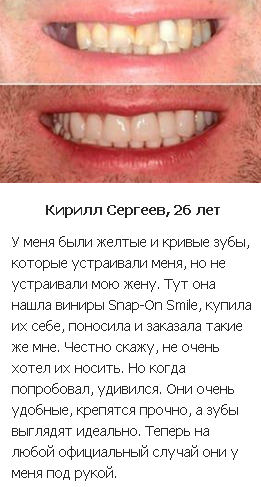 Snap On Smile отзывы