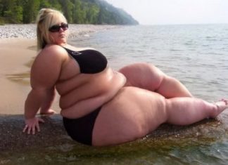 Мнение врача: единственный способ, который поможет при болезненном ожирении