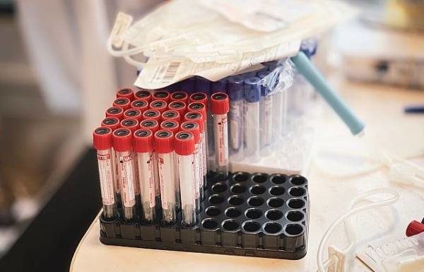 Сколько россиян готовы стать донорами костного мозга?