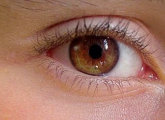 Как избавиться от мешков под глазами?