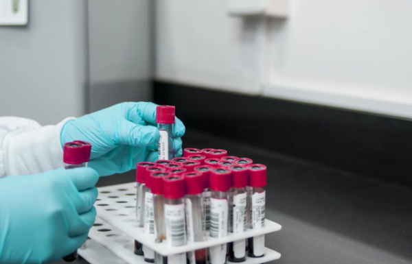 Когда раньше объявлялась пандемия и в связи с чем?